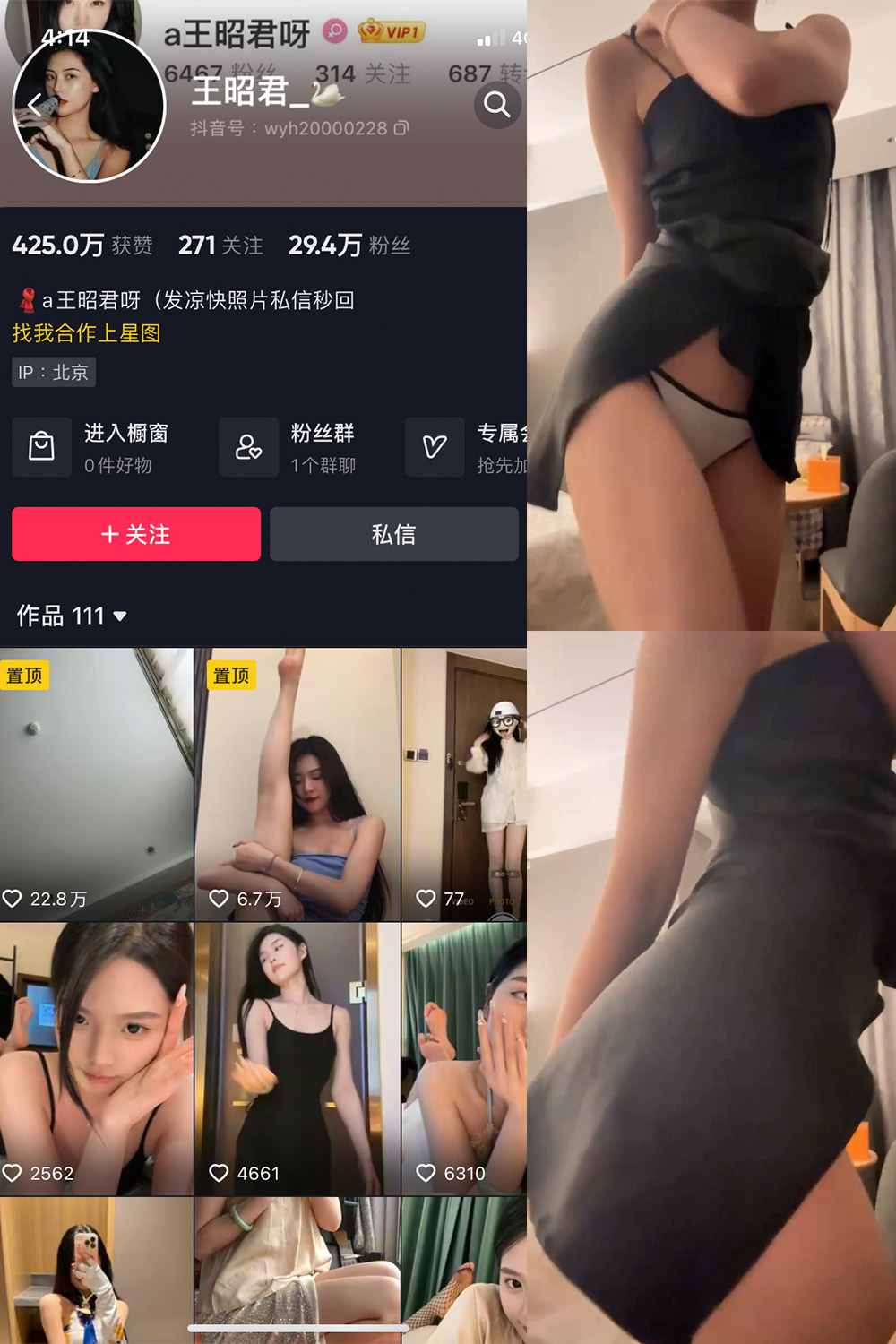 抖音 王昭君 微密圈 NO.010期 【11P1V】最新至:2023.6.10