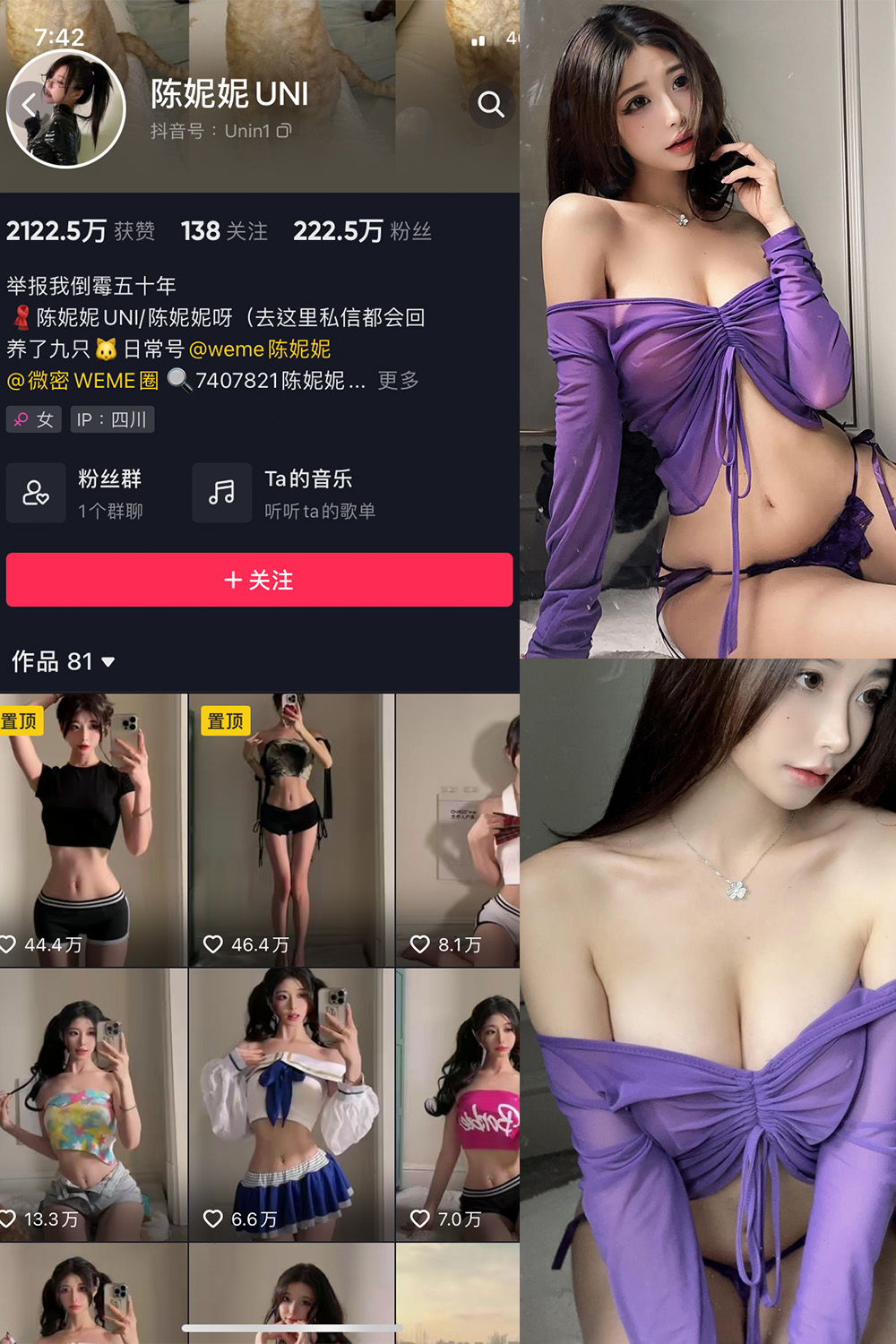 抖音 陈妮腻UNI 微密圈 NO.072期 【21P1V】最新至: