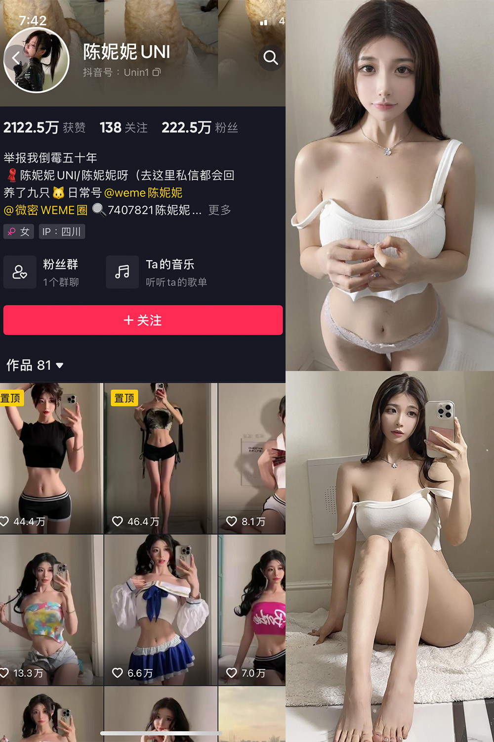 抖音 陈妮腻UNI 微密圈 NO.063期 【24P1V】