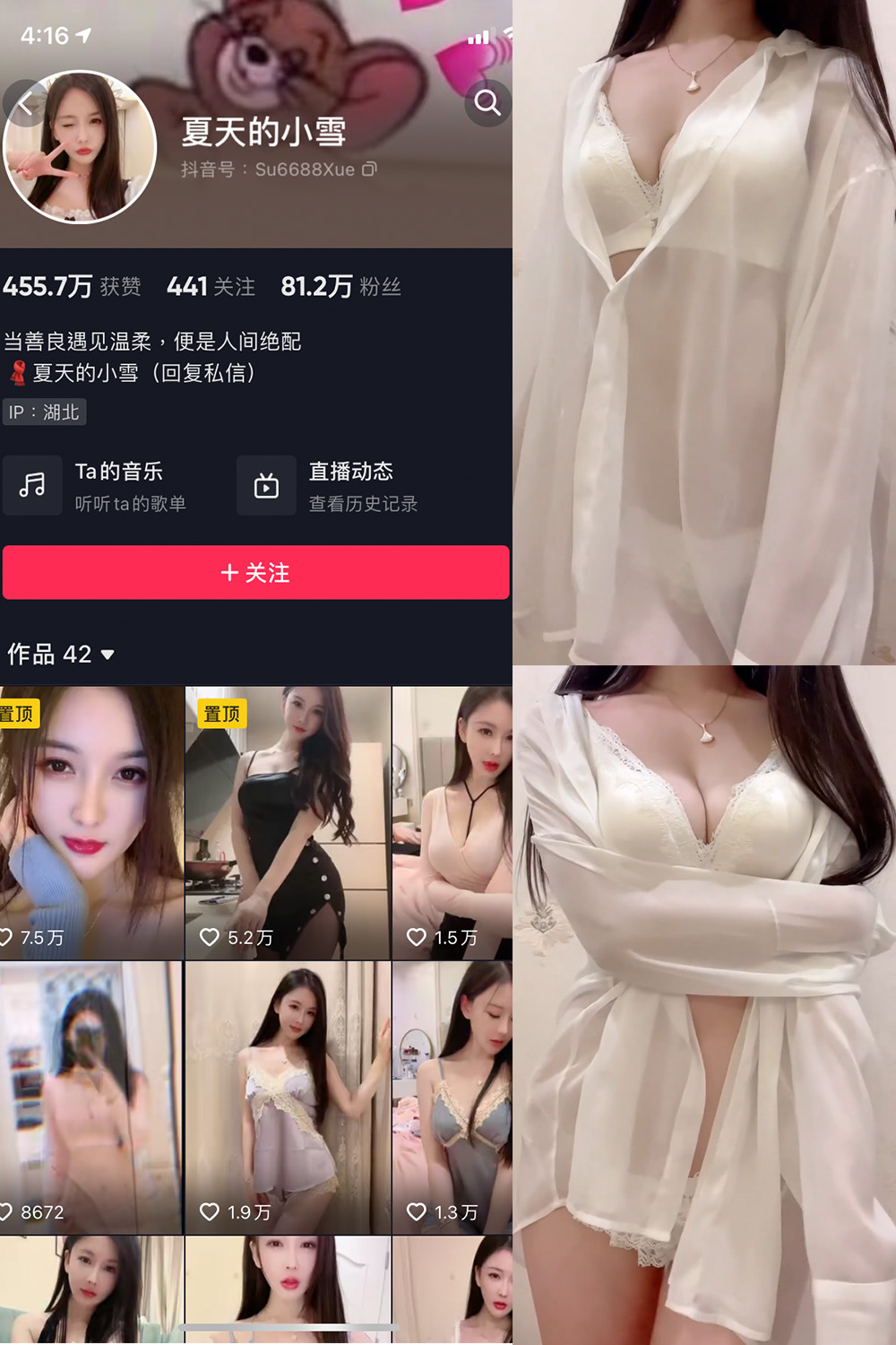 抖音 夏天的小雪 微密圈 嘉宾专享 NO.011期 【4P2V】最新至: